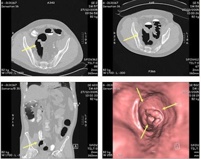 2006 12 05 14 35 30 706