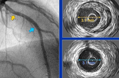 2006 12 06 13 39 13 706