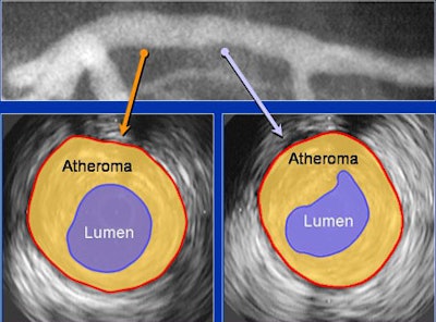 2006 12 06 13 39 25 706