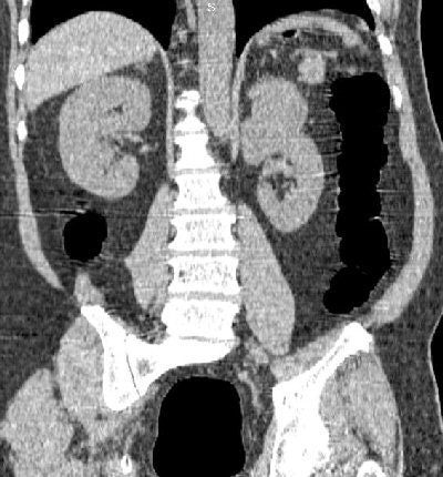 2006 12 12 17 18 07 706