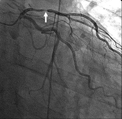 2006 12 18 10 34 01 706