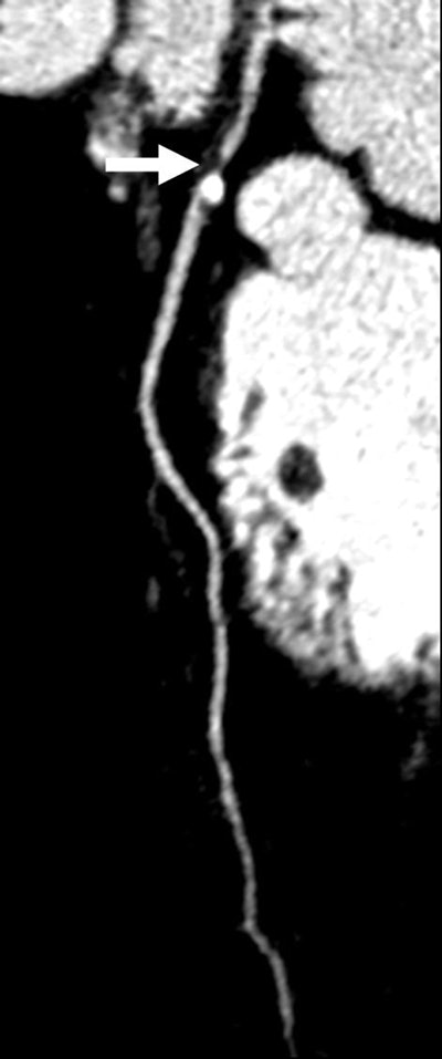 2006 12 18 10 34 19 706