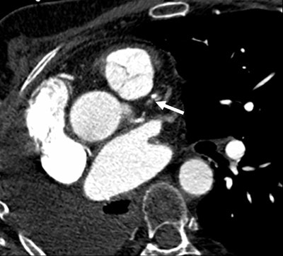 2006 12 18 10 34 39 706