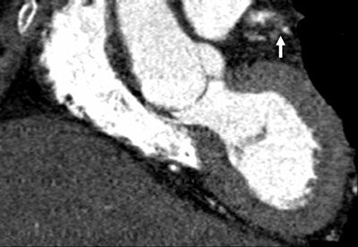 2006 12 18 10 34 54 706