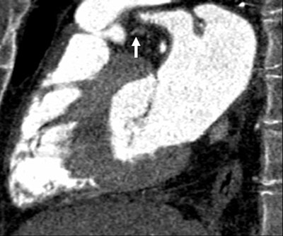 2006 12 18 10 35 08 706