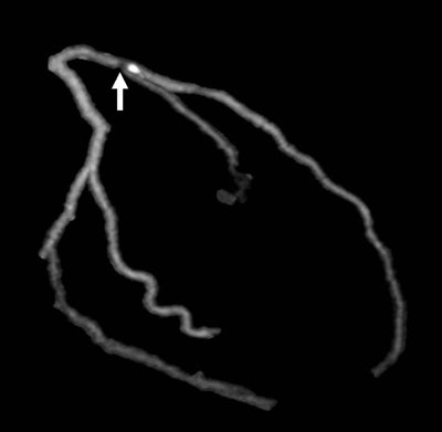 2006 12 18 10 35 23 706