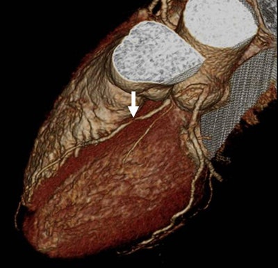 2006 12 18 10 45 21 706