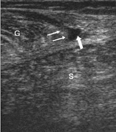 2006 12 28 15 13 37 706