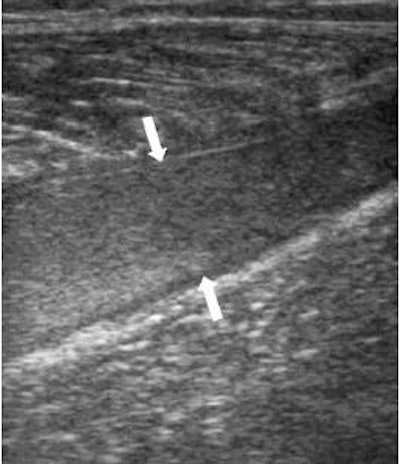 2006 12 28 15 17 48 706