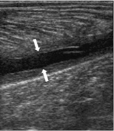 2006 12 28 15 19 43 706