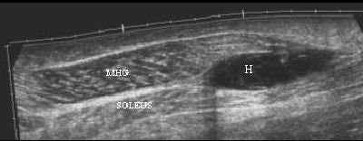 2006 12 28 15 26 29 706