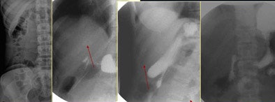 2007 01 08 14 40 21 706