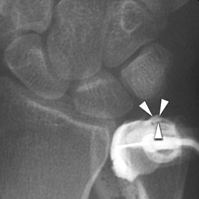 2007 01 12 12 46 52 706