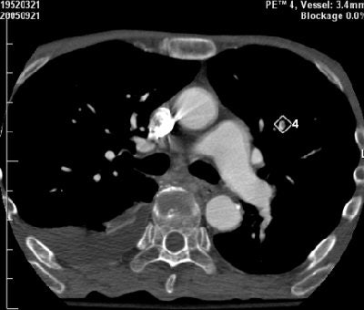 2007 01 15 15 11 59 706