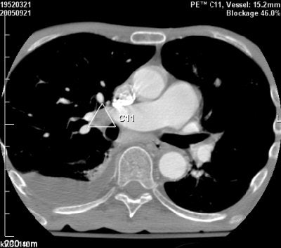 2007 01 15 15 12 12 706