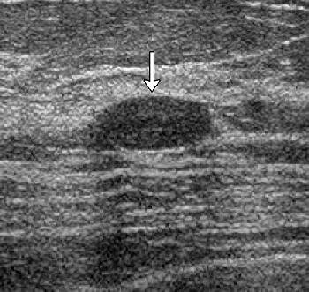 2007 02 05 15 40 26 706