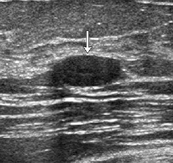 2007 02 05 15 40 41 706