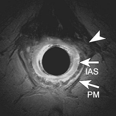 2007 02 06 16 33 10 706