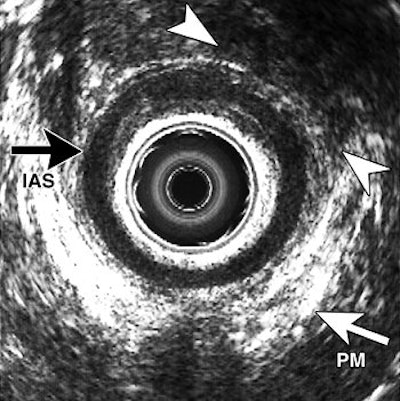 2007 02 06 16 33 25 706