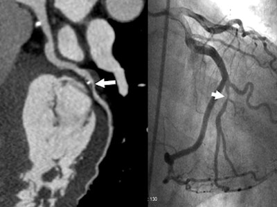 2007 02 14 17 25 19 706