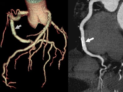 2007 02 14 17 25 30 706