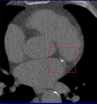 2007 02 28 11 23 52 706