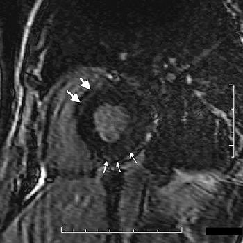 2007 03 05 00 13 58 706