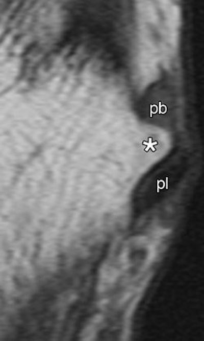 2007 03 09 16 50 09 706