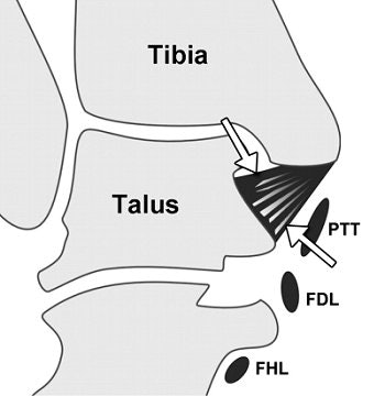 2007 03 09 16 50 49 706