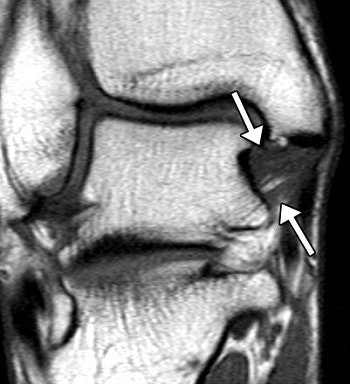 2007 03 09 16 51 05 706