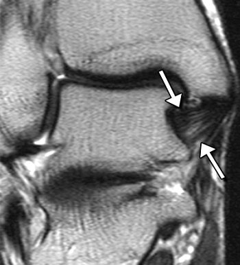 2007 03 09 16 51 20 706