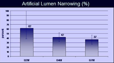 2007 03 11 09 55 50 706