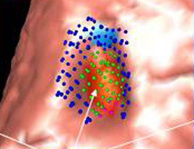 2007 03 12 11 35 57 706