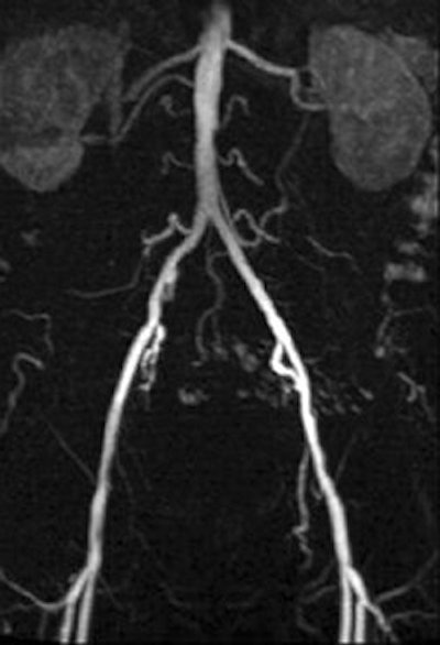 2007 03 19 13 55 38 706