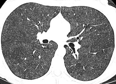 2007 03 27 14 35 15 706