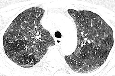 2007 03 27 14 35 28 706