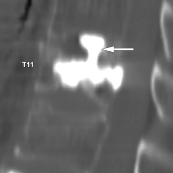 2007 04 02 13 27 20 706