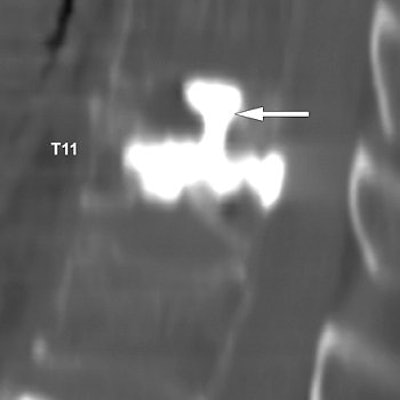 2007 04 02 13 27 20 706