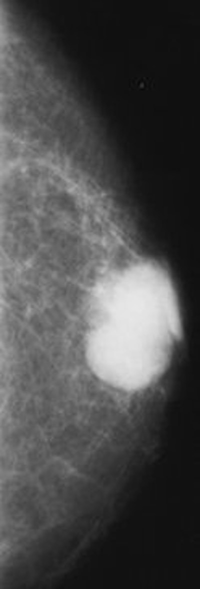 2007 04 03 14 26 25 706