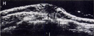 2007 04 03 14 26 53 706