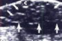 2007 04 03 14 27 03 706