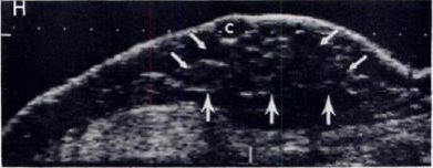 2007 04 03 14 27 23 706