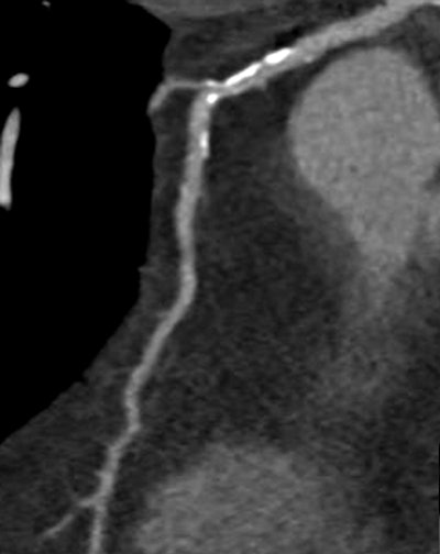 2007 04 06 16 28 13 706