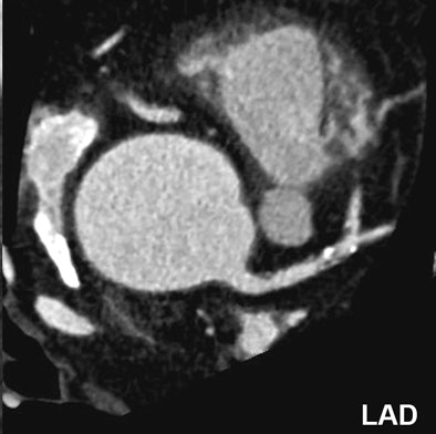 2007 04 06 16 29 43 706