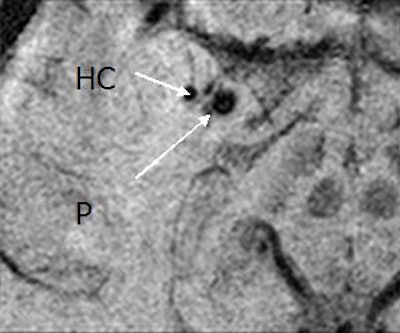 2007 04 17 14 05 37 706