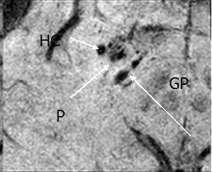 2007 04 17 14 05 50 706