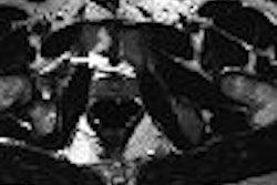 2007 04 20 11 25 06 706