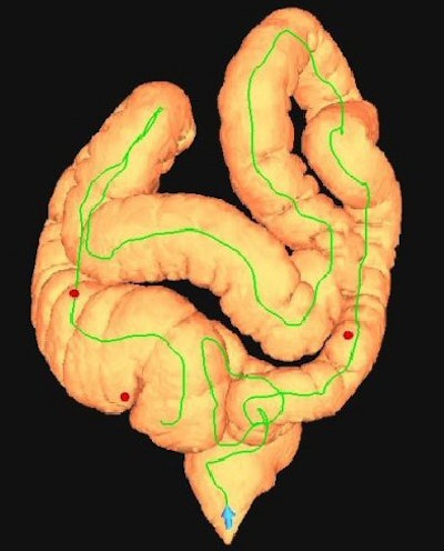 2007 04 23 13 44 36 706