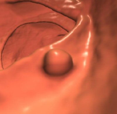 2007 04 23 13 44 49 706