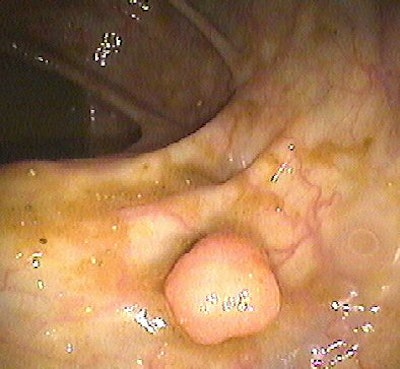 2007 04 23 13 45 06 706